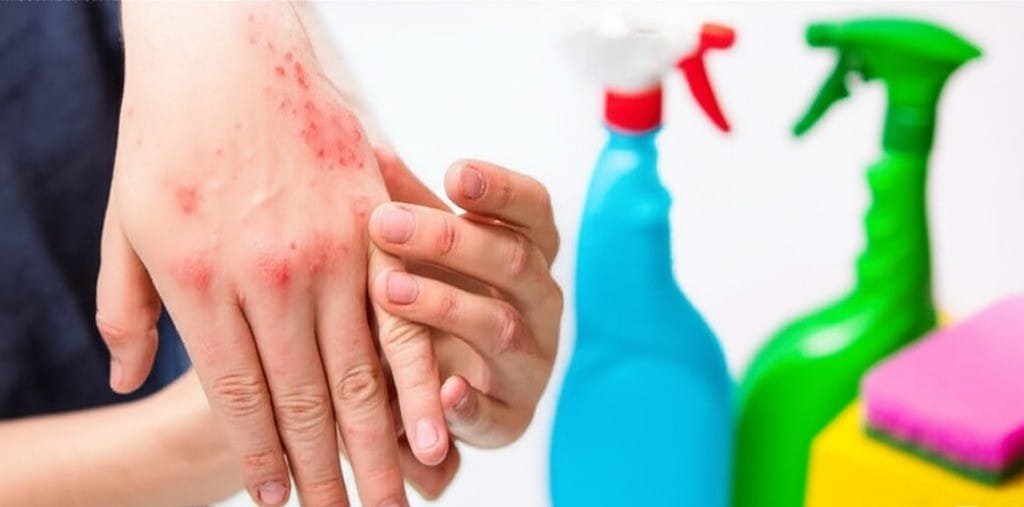 person with allergy